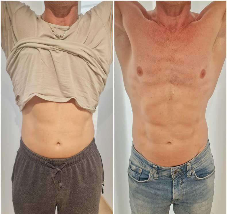 Vorher und nachher bild von einem EMP Training von ein Mann. Bauchmuskeln